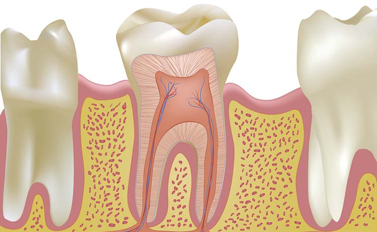 Root Canal Treatment in Littleton