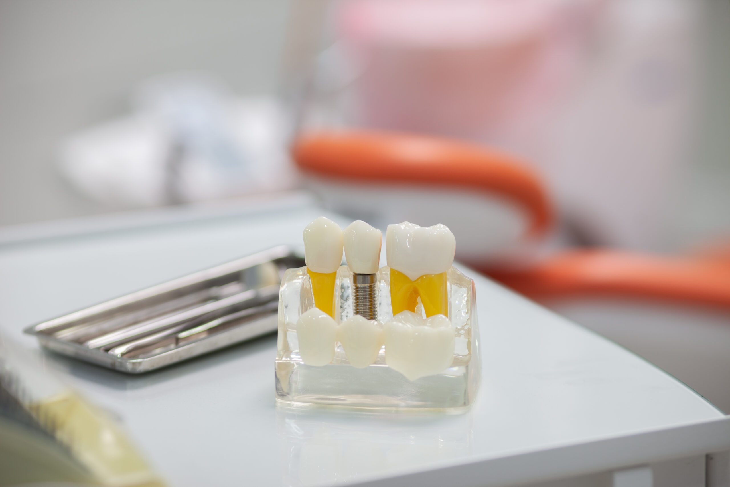 Solution for Missing teeth