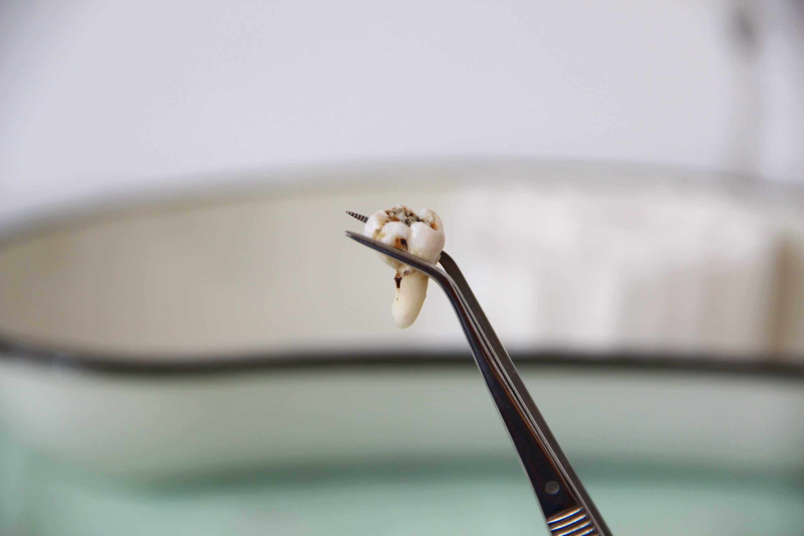 wisdom teeth removal recovery