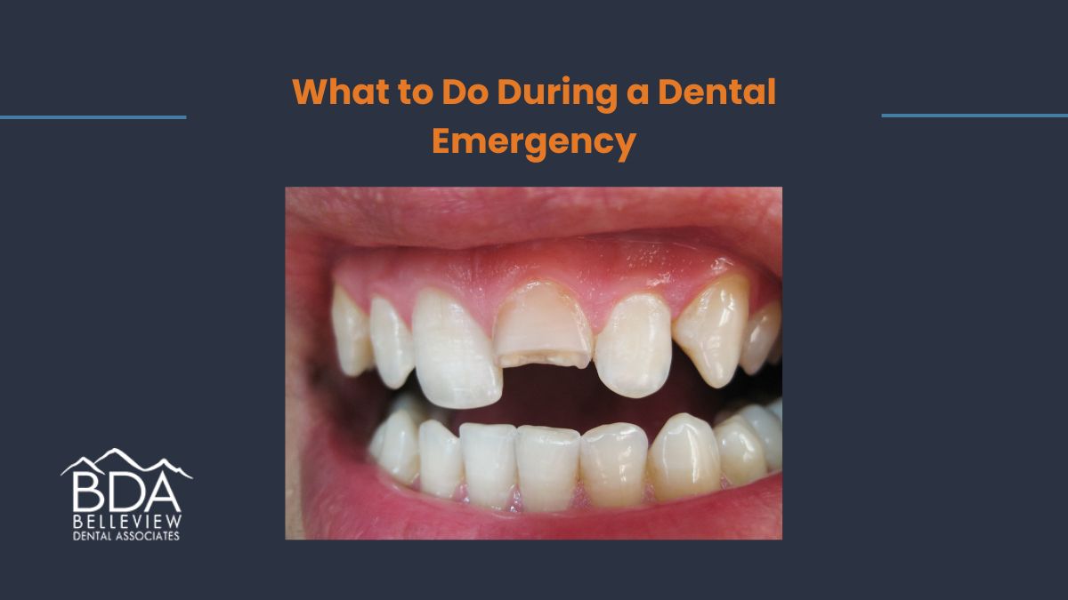 What to Do During a Dental Emergency