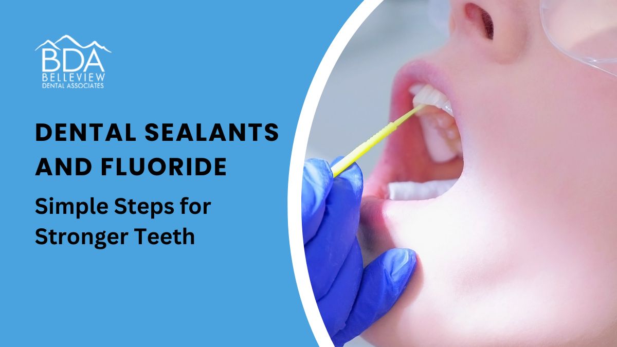 Dental Sealants and Fluoride