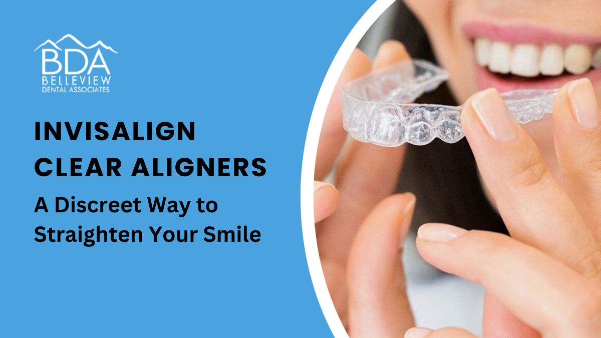 Invisalign Clear Aligners