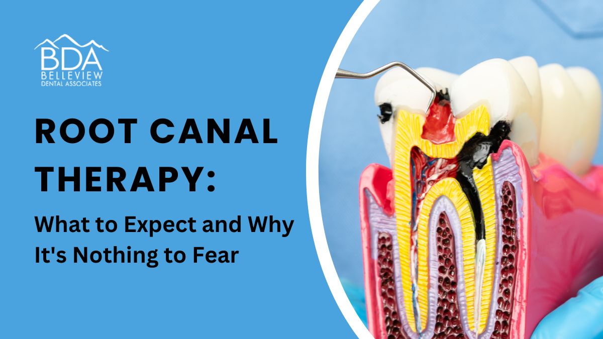 Root Canal Therapy