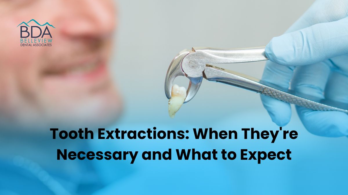 Tooth Extractions