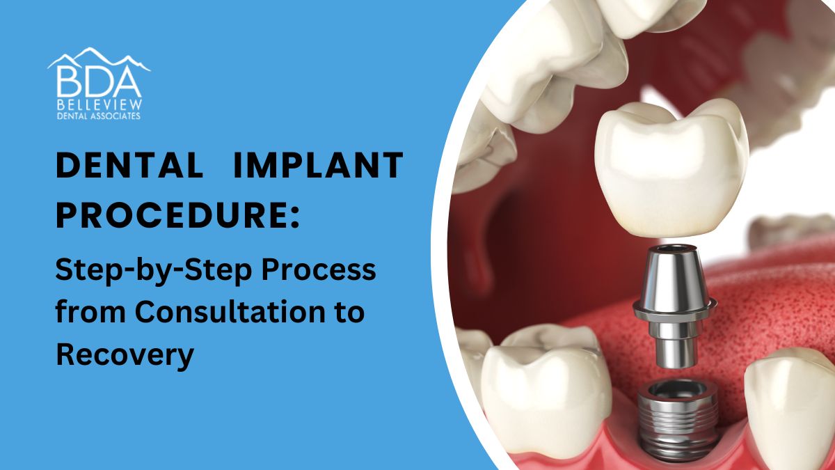 Dental Implant Procedure