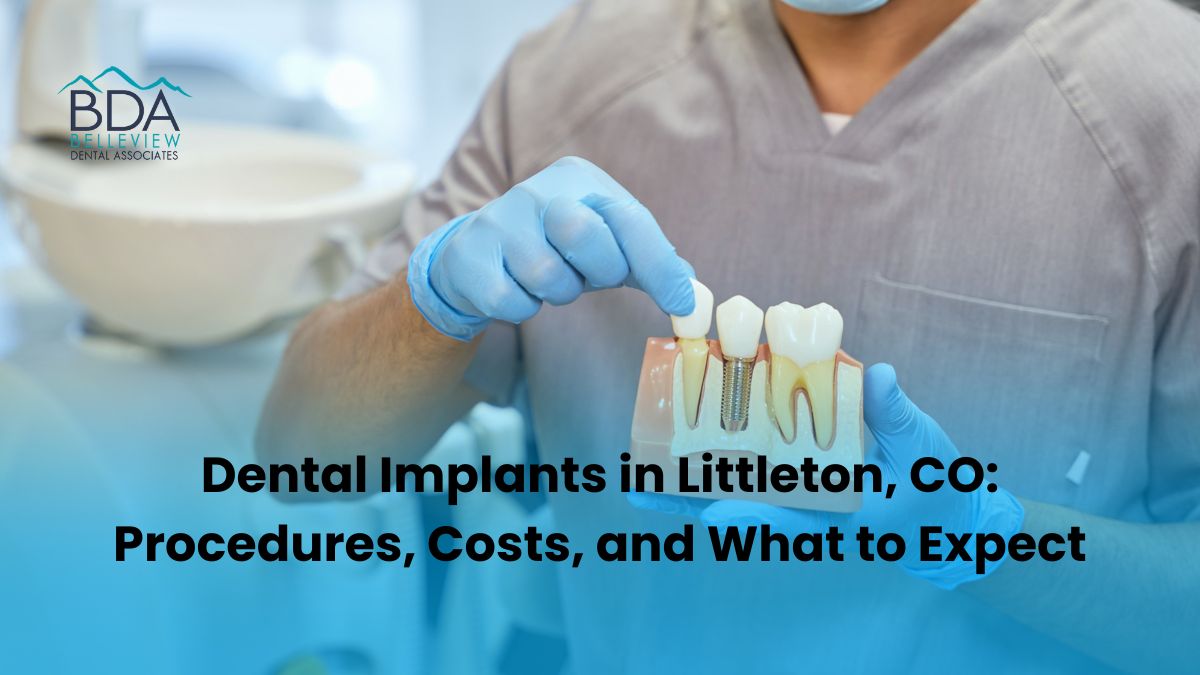 Dental Implants in Littleton CO