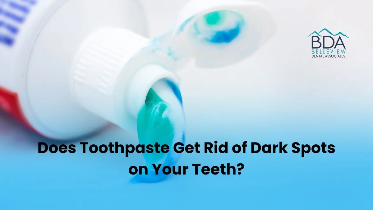 Does Toothpaste Get Rid of Dark Spots on Your Teeth