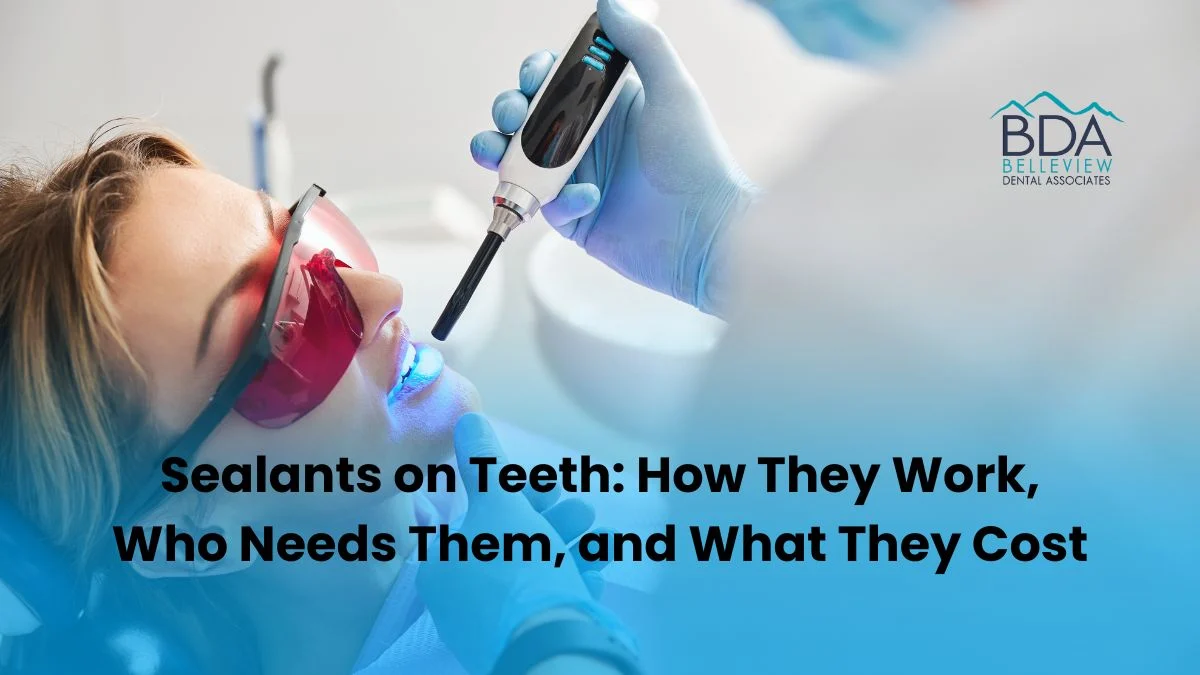 Sealants on Teeth