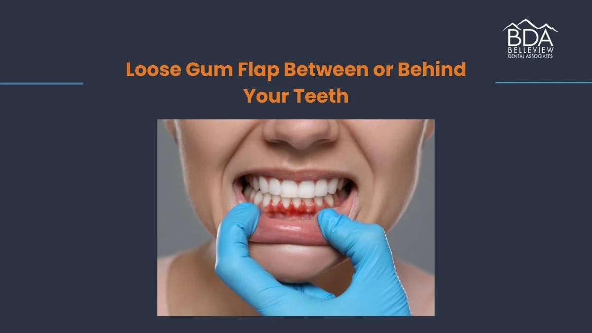 Loose Gum Flap Between or Behind Your Teeth